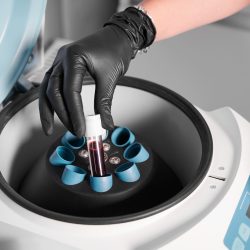 ELHODA AUTO-ANALYZER SERIES REAGENTS